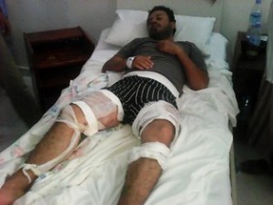 جهاد محمد مهيوب في مستشفى (أدنا آدن) بمدينة هرجيسا1 (1)